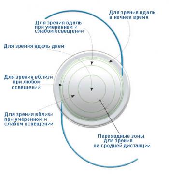 мультифокальный хрусталик 